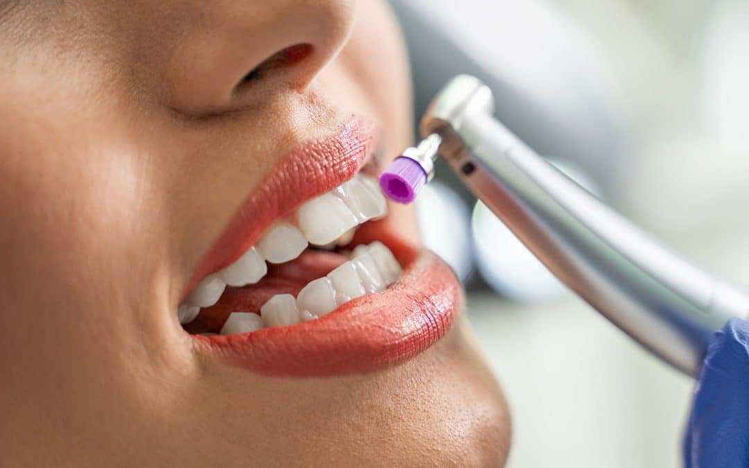 Cosmetic dental procedures in Ridgeland, MS